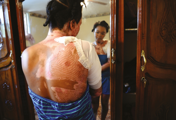 Cortes de energia são comuns no Haiti. Após as 18h, Christelle, de 27 anos, precisa usar uma vela.
