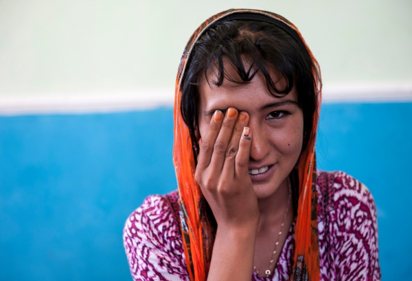 Uma paciente de 16 anos de idade com tuberculose ultrarresistente (TB-XDR) no Tadjiquistão perdeu a visão em um dos olhos – efeito colateral do tratamento de dois anos que envolve a ingestão de medicamentos tóxicos (cerca de 14 mil comprimidos) e tem apenas 22% de taxa de cura. Dados recentes indicam que, em algumas regiões, a tuberculose resistente a medicamentos (TB-DR) está sendo transmitida de pessoa para pessoa cada vez mais. (Foto: Wendy Marijnissen)